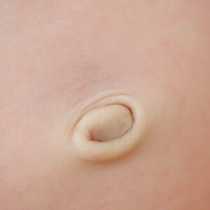 cuidados-del-ombligo