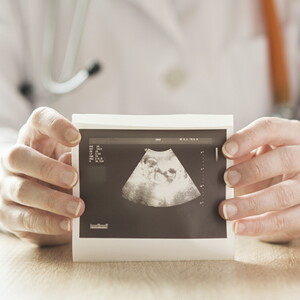 ¿Qué hace el  líquido amniótico?