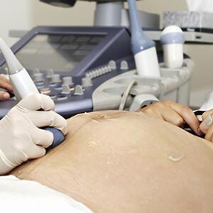 18 semanas de embarazo