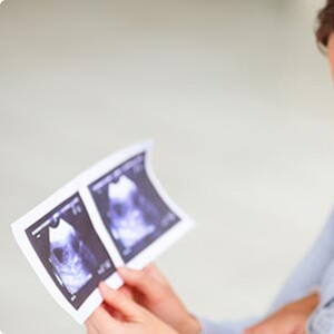 8 semanas de embarazo